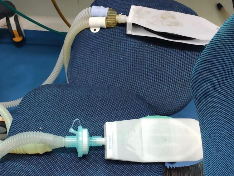 Técnica validada permite que até quatro pacientes sejam conectados ao mesmo respirador